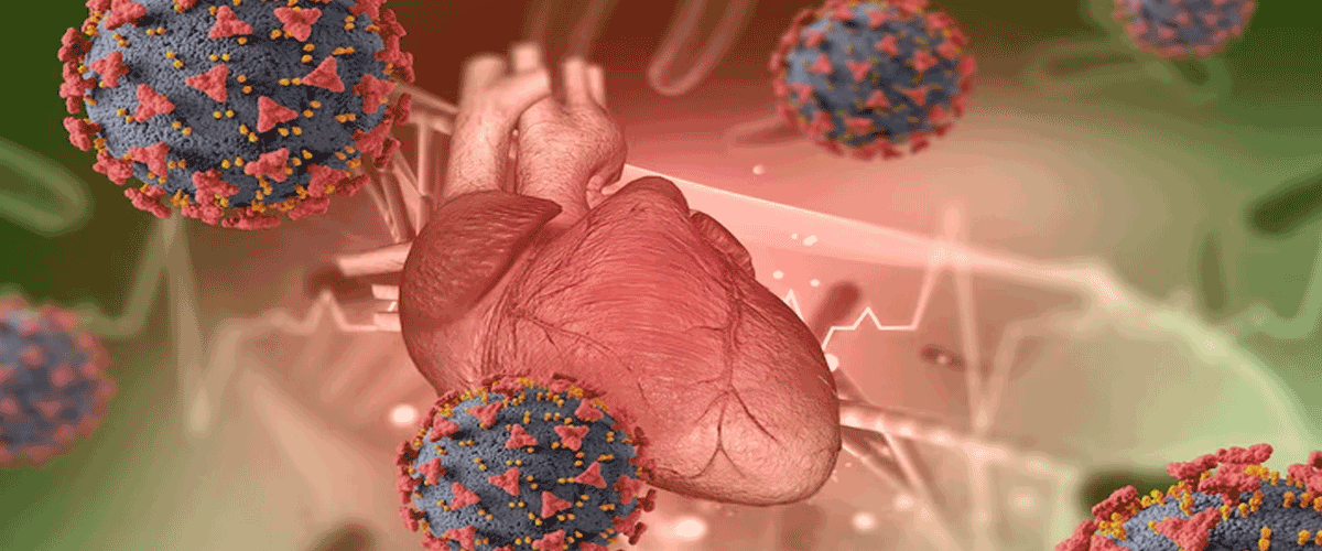 Environmental Pollution Now a Major Driver of Global Cardiovascular Disease