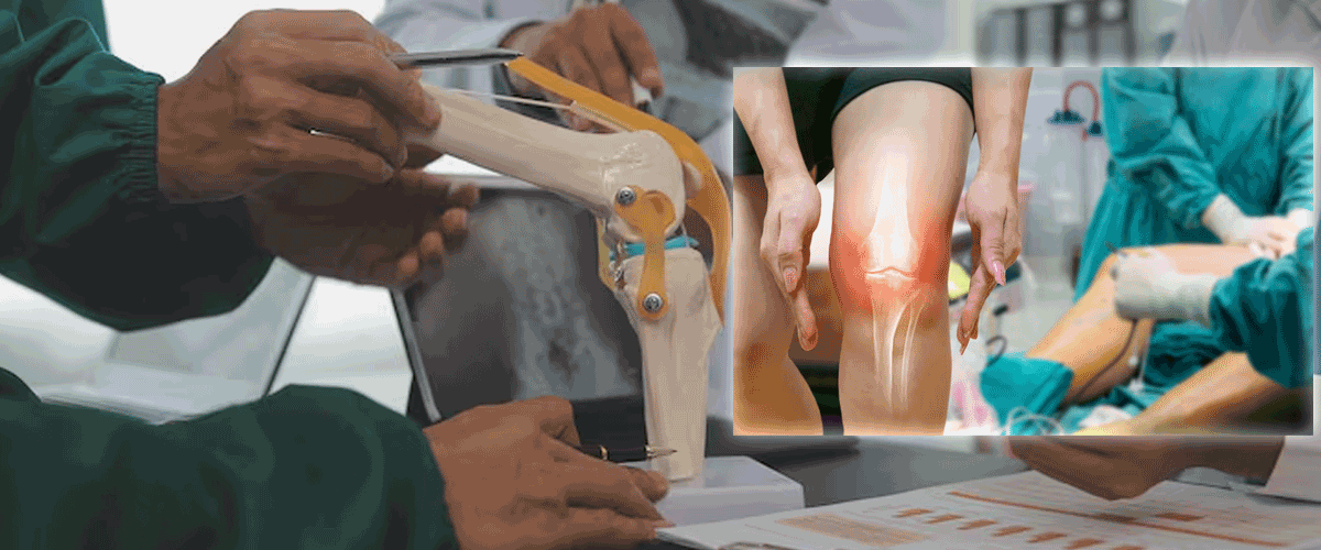 ArthroLense and Waldemar Link Partner to Advance 3D-Enhanced Knee Surgery