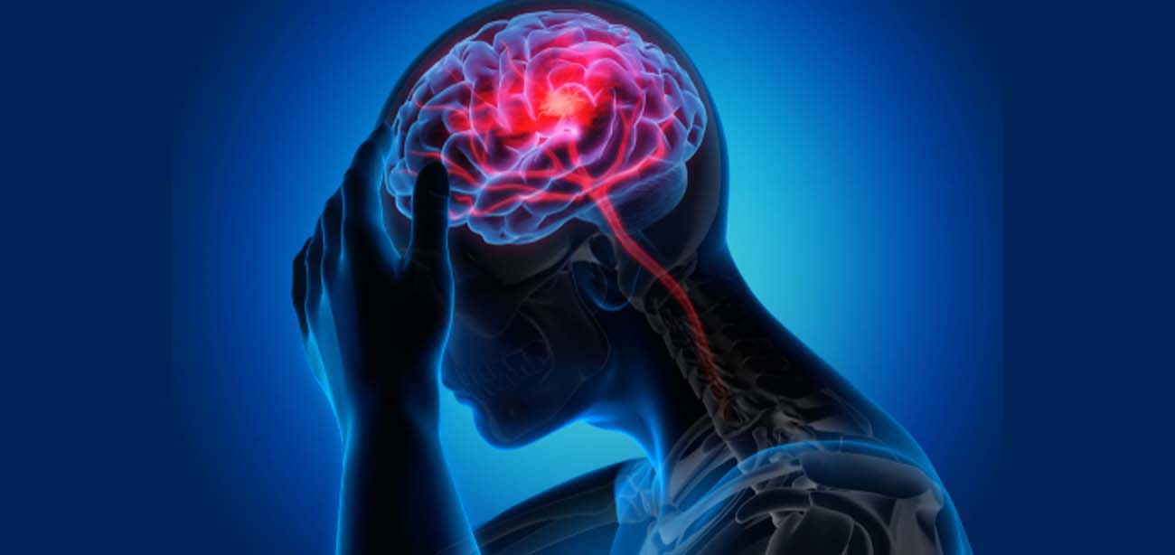 FDA Grants First Approval for Venous Stent to Treat Severe IIH