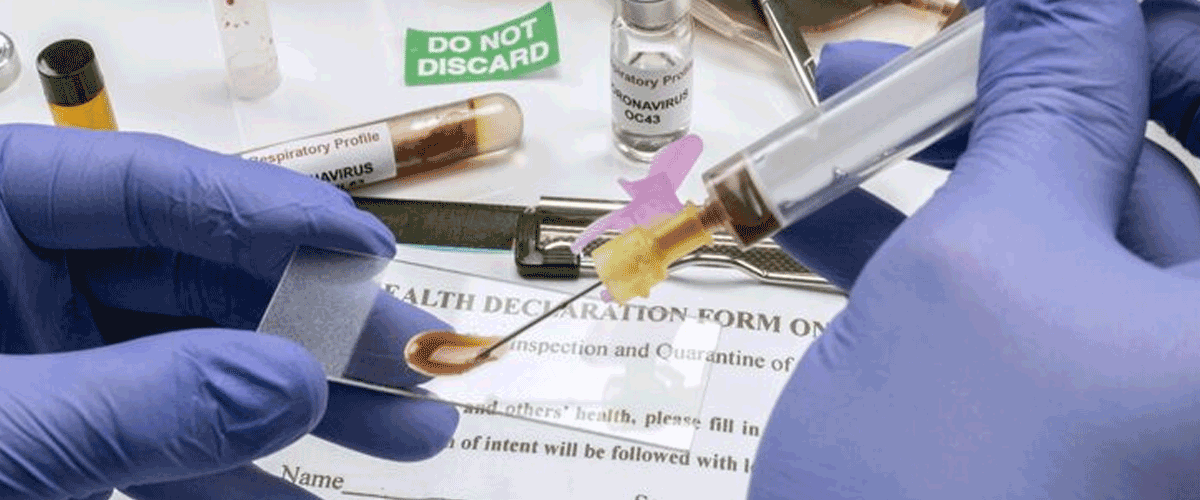 Imugene Reports Encouraging Efficacy from Phase Ib Azer-cel Trial in DLBCL