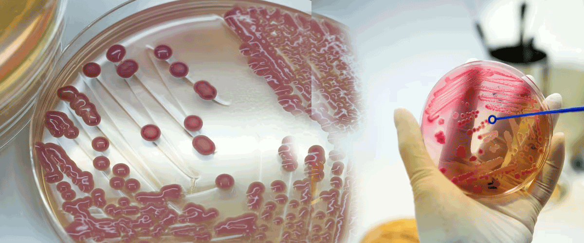 Celldex Halts Barzolvolimab Development in Eosinophilic Esophagitis After Phase II Setback