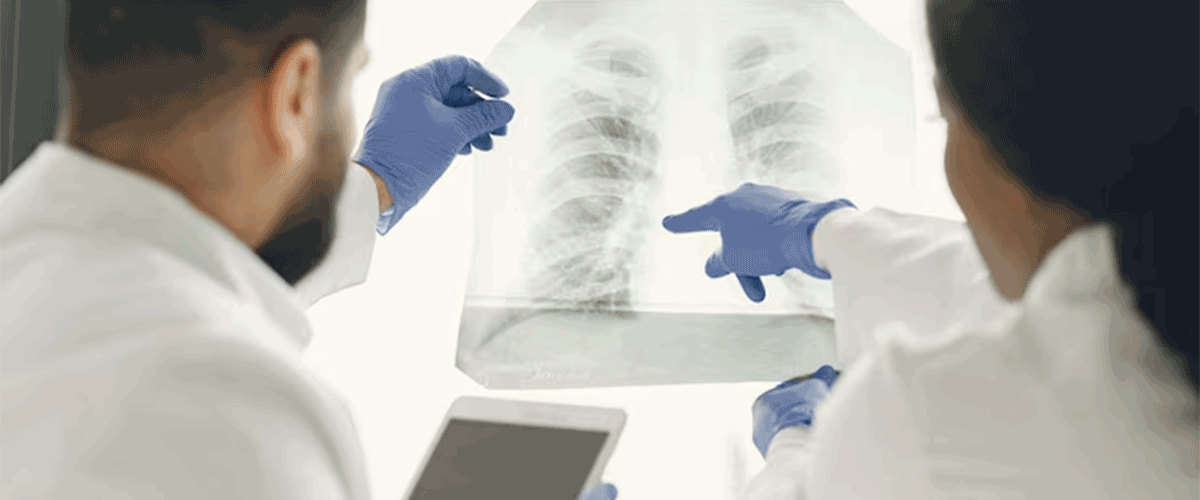 Roche’s Astegolimab Shows Mixed COPD Trial Results, Future Uncertain