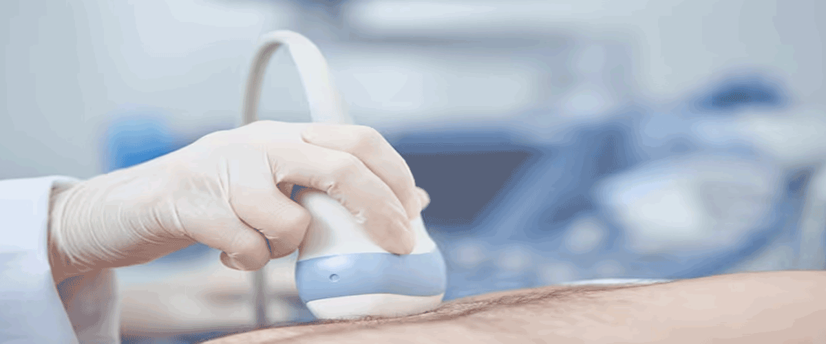 Precision Ultrasound Shows Promise for Organ-Preserving Prostate Cancer Therapy