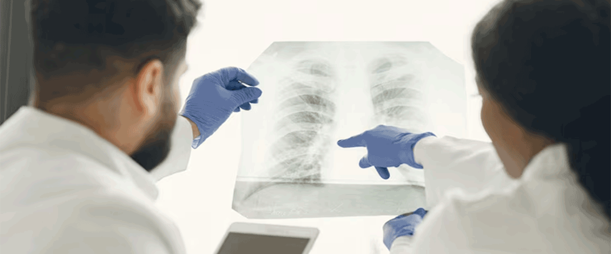 Moleculin Reports Positive Annamycin Trial Results for STS Lung Metastases