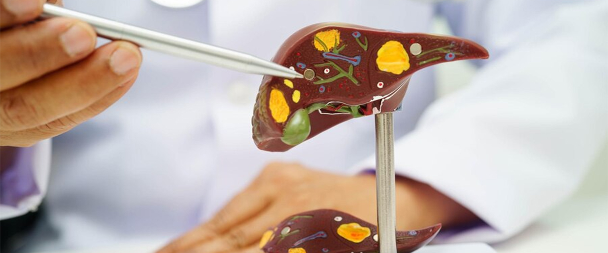 UniQure Pauses Dosing of Fabry Gene Therapy Over Liver Safety Concerns