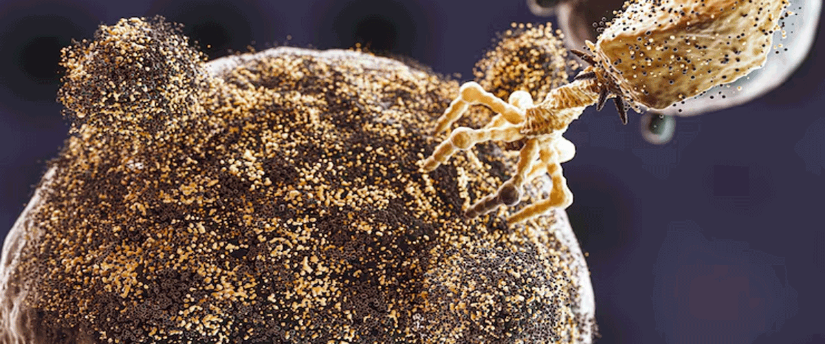 Microplastics Linked to Alzheimer’s-Like Changes in Genetically Susceptible Mice