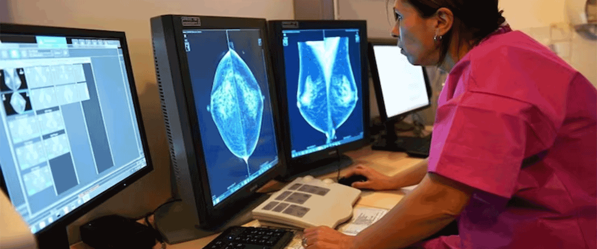 ASCO25: Merck KGaA ADC Shows Promise in Colorectal Cancer Trial