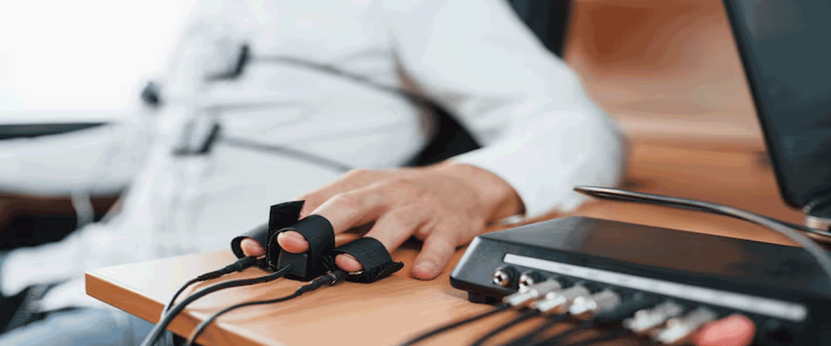 Johnson & Johnson Recalls Cerepak Aneurysm Coils After Detachment Failures