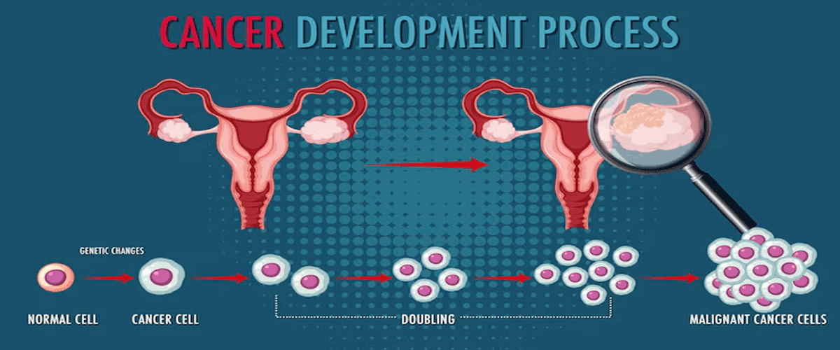 BioInvent Antibody Shows Encouraging Activity with Keytruda in Ovarian Cancer