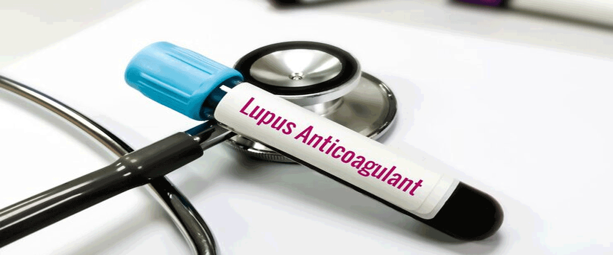 J&J’s Nipocalimab Advances to Phase III After Positive Lupus Trial