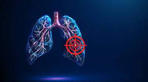 Zegfrovy Shows Strong Results in Phase III Lung Cancer Trial