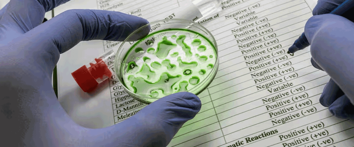 Hologic Gains FDA Clearance for First GI Pathogen Detection Assays