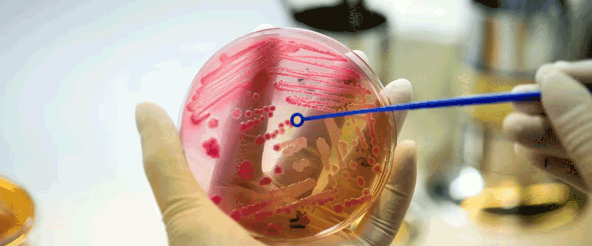 Study Links Placental Microplastics to Increased Risk of Miscarriage