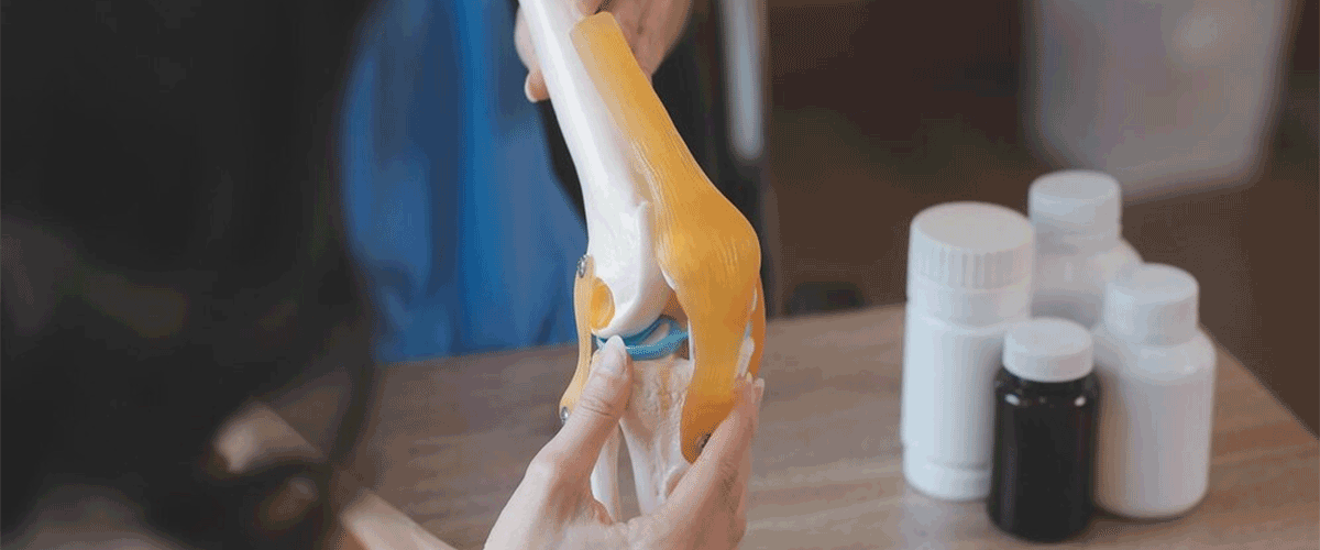 Tremfya Shows Positive Results in Phase IIIb Trial for Psoriatic Arthritis