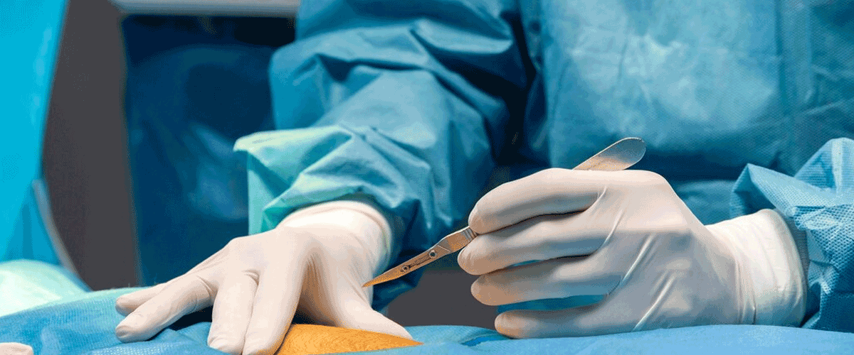 Safer Gallbladder Surgery Now Possible for High-Risk Patients