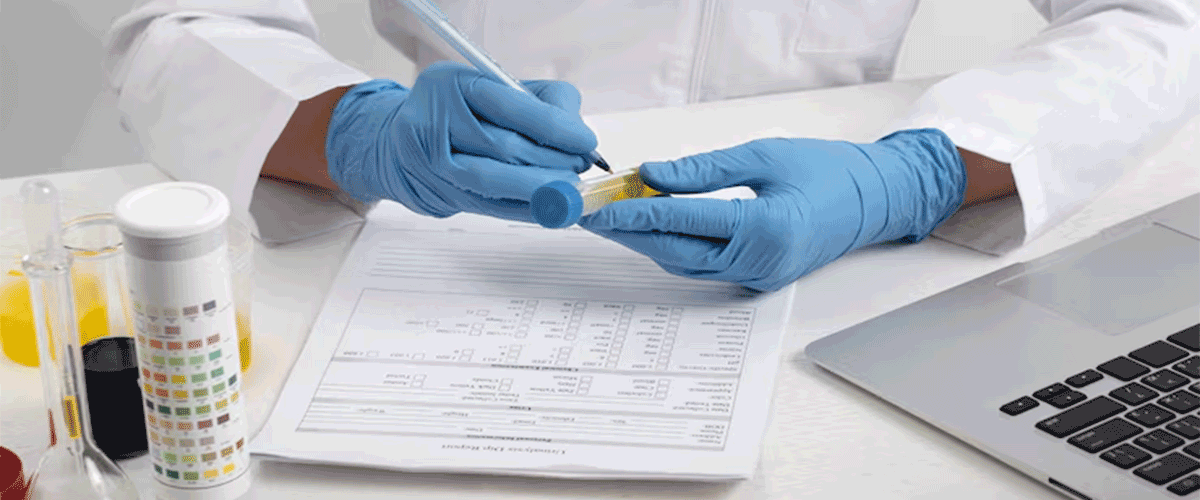 Mineralys Reports Positive Results from Phase III Lorundrostat Trial for Hypertension