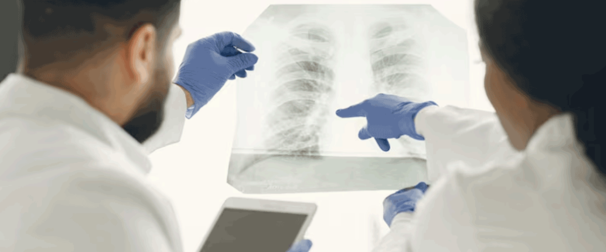 FDA Clears Exactech’s Scapula Reconstruction System