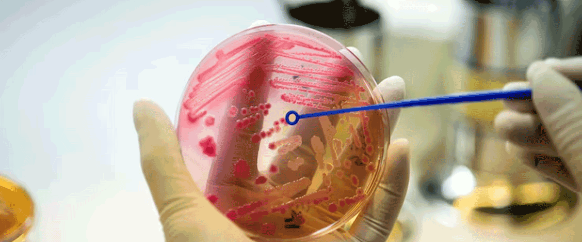 Microplastics in Placenta May Disrupt Fetal Hormone Development