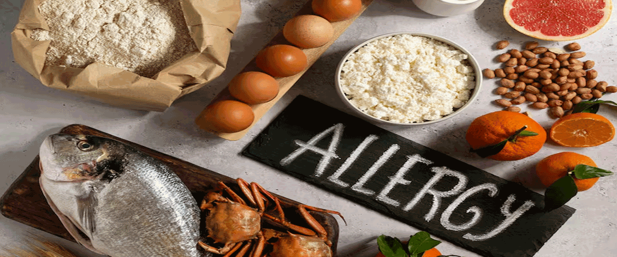 Surge in U.S. Food Recalls Driven by Allergen and Contamination Risks